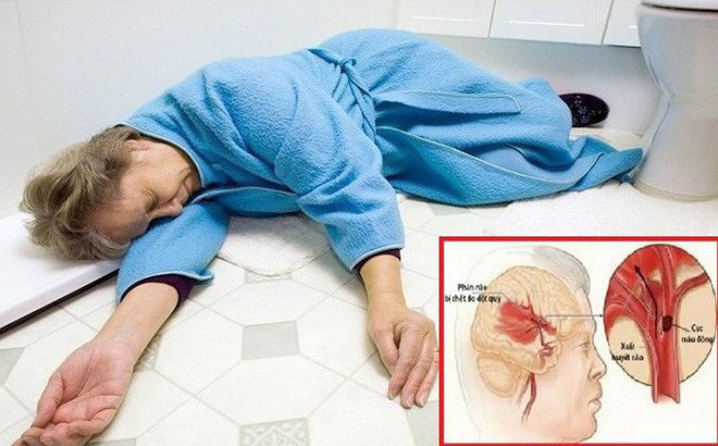 Đây là 2 thời điểm dễ bị đột quỵ nhất, nghe chuyên gia hướng dẫn cách phòng tránh